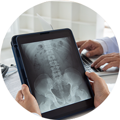 X-ray 검사
